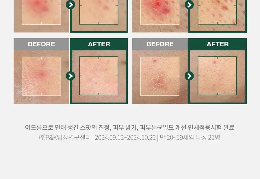 [수분진정로션/본품증정] 닥터지 레드 블레미쉬 포 맨 플루이드/폼 2종 기획 세트 상세페이지 21